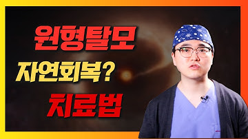 원형탈모는 자연회복 된다? 치료법은?