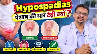 Hypospadias in Children: पेशाब की धार टेढ़ी क्यों आती है ? Surgery और सही उम्र