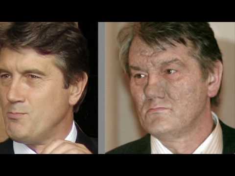 Video: Yushchenkos Vergiftung: Versionen. Dritter Präsident der Ukraine Viktor Juschtschenko