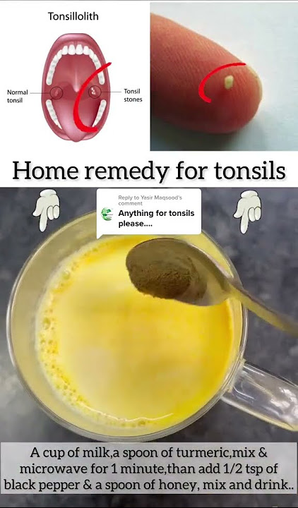 Obat Terbaik untuk Menyembuhkan Amandel.. #amandel #batuamandel #amandel