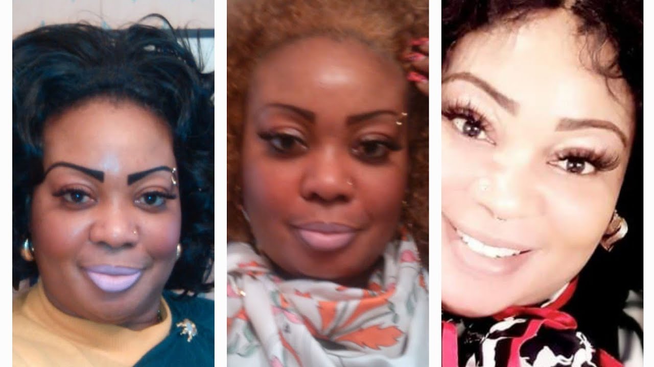 strong bleaching creams to stop hyperpigmentation permanently dm 413 309 3254 - YouTube