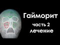 Гайморит - моя болезнь, лечение