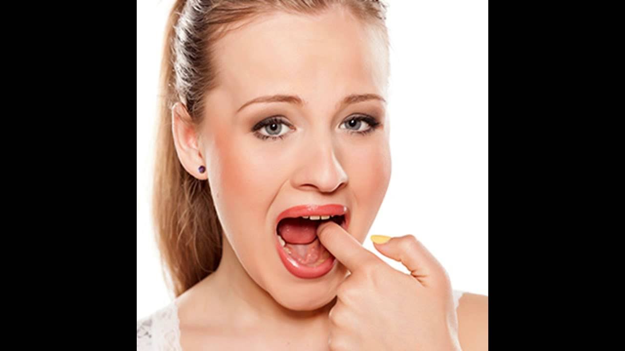 Как лечить и Лечение язвы во рту - YouTube