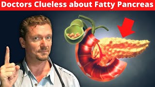Doctors Clueless about Fatty Pancreas [Worse than Fatty Liver] 2024 screenshot 3
