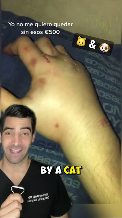 Cat and Dog Bites