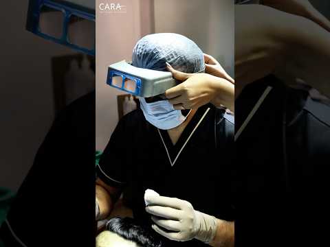 اكتشاف أسرار جراحة زراعة الشعر