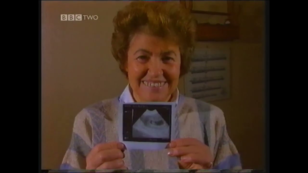 [Partial] Whose Body? (BBC Two, 8th July 2003)