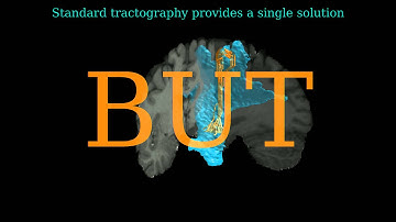 Teaser video for GP Tractography at MICCAI 2014