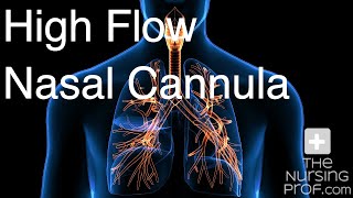 High Flow Nasal Cannula