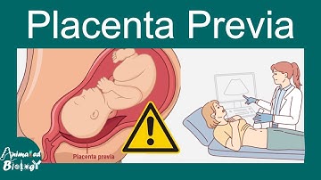 Placenta Previa | Cause , symptoms and treatment of Placenta previa | USMLE step 1