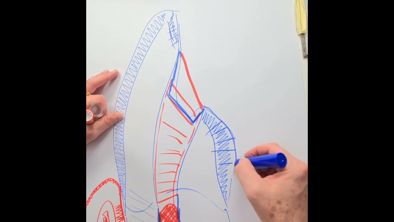 WALKING BLEACH TECHNIQUE PART 2