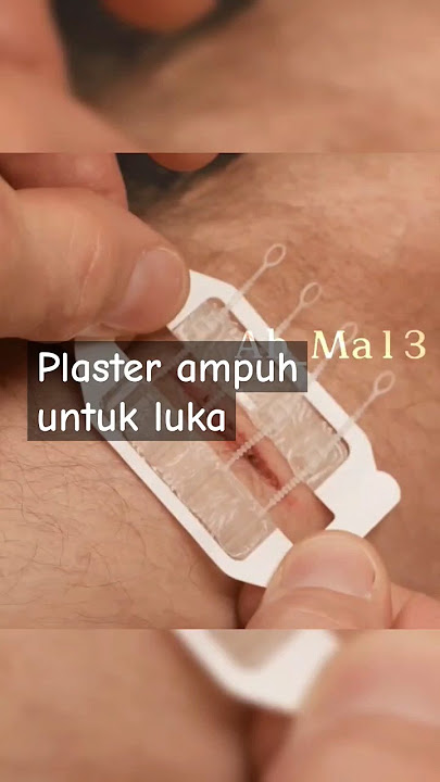 plaster pengganti jahitan untuk luka robek #shortvideo #shorts