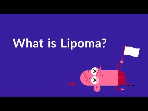 लिपोमा क्या है? (त्वचा के नीचे मोटी गांठ)