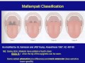 20150817 Preparation and Mgmt Known Difficult Airway