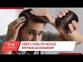 Dandruff Solutions That Work! Say Goodbye To Winter Itch With These Easy Remedies