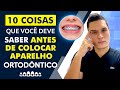 10 COISAS QUE VOCÊ DEVE SABER ANTES DE COLOCAR APARELHO ORTODÔNTICO!!!