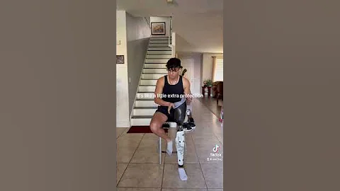 How I put on my prosthetic leg - DayDayNews