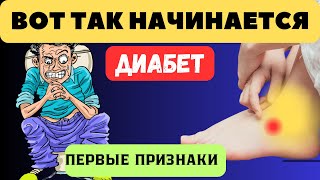 Ещё нет диабета, но... есть ,  10 признаков высокого сахара! Что делать?