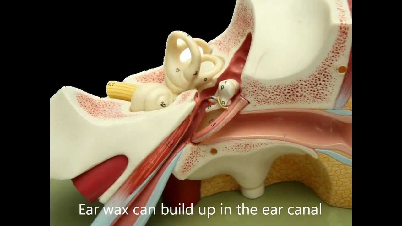 London Hearing Aids and Ear Specialists YouTube