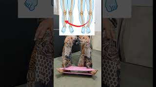 #physiotherapy #kneepain