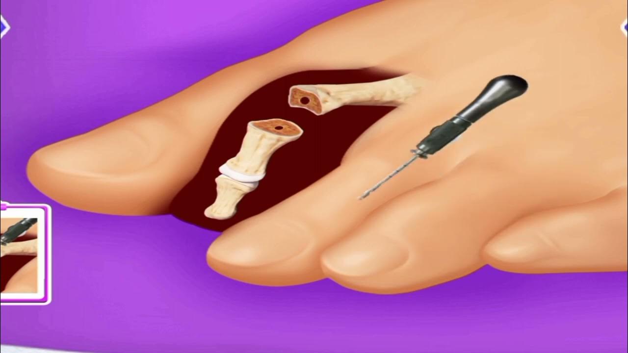 ASMR foot video foot finger injury asmr foot asmr animation asmr footasmr YouTube