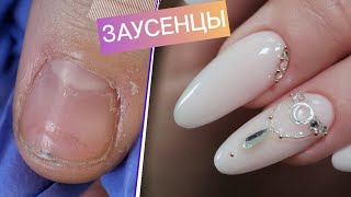 Свадебные ЗАУСЕНЦЫ 😱 Свадебный маникюр с треснувшей кутикулой. 💎 Наращивание ногтей со стразами