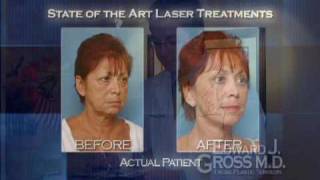 Our Array of Skin Rejuvenation Treatments