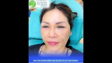 Độn thái dương có duy trì lâu dài không? Địa chỉ uy tín để thực hiện tại TPHCM ?