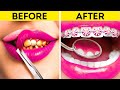 RICH VS BROKE DENTIST | CRAZY &amp; FUNNY RICH VS POOR SITUATIONS by challenge accepted