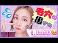 ⚠️閲覧注意⚠️ウォーターピーリングって実際どうなの？【毛穴の黒ずみ いちご鼻】