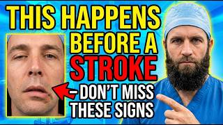THIS HAPPENS BEFORE A STROKE — DON’T MISS THESE SIGNS