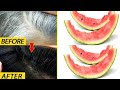 From white hair to dark hair naturally using red watermelon peels, 100% effective