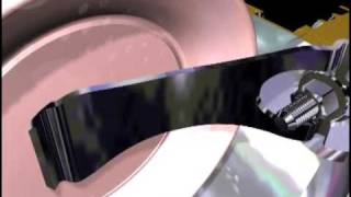 Mares VAD System