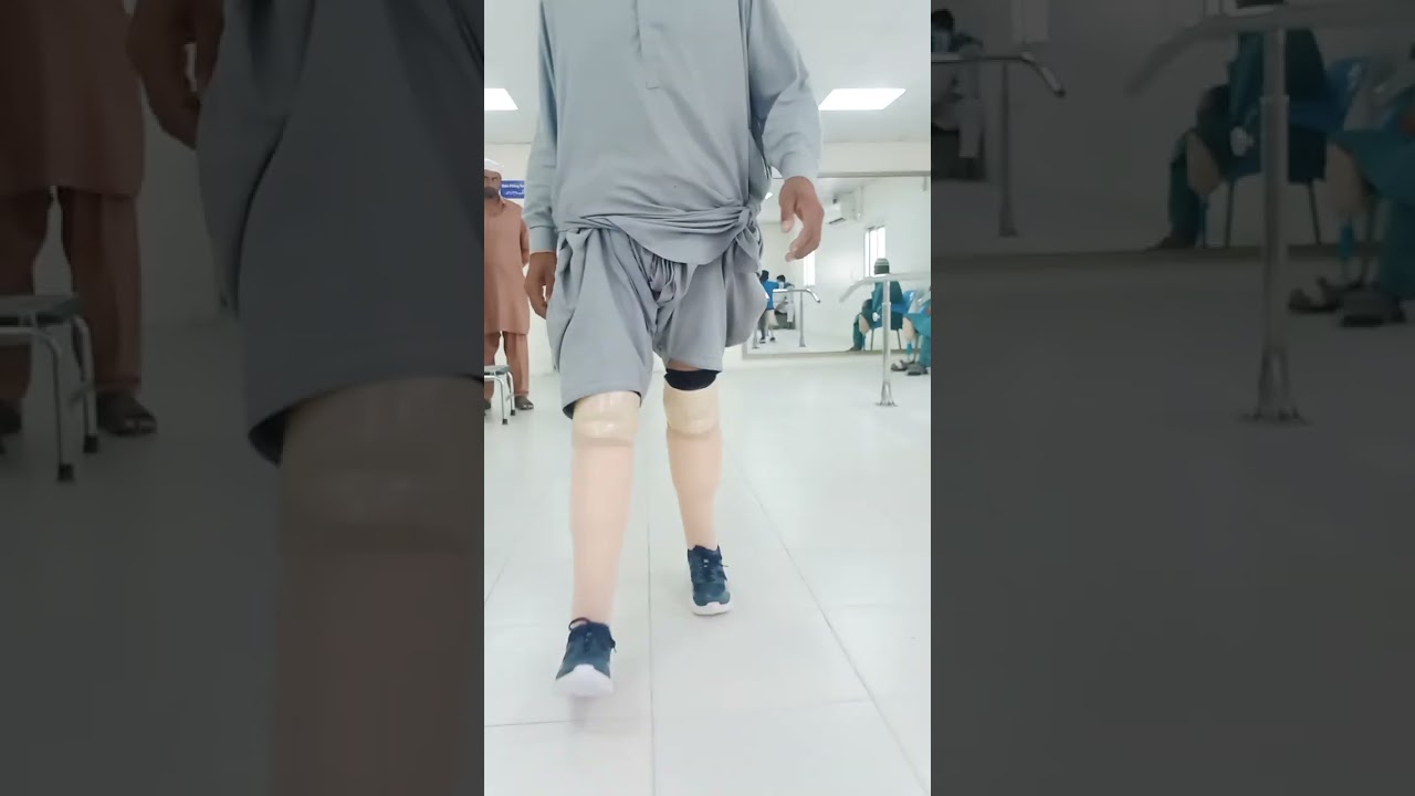 Bilateral amputee walking 🦾🦿 #foru #1milio #1000subscriber #hospital #13million #unfrezzmyaccount