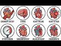 Every MAJOR Cardiovascular Disorder &amp; Its Effects Explained In 22 Minutes