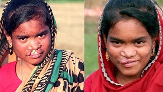 After 14 Years of Wandering, Tanzila Finds Her Smile | Smile Train
