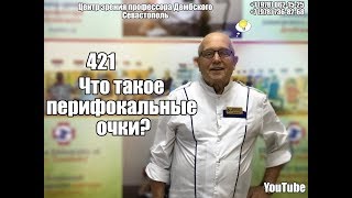 #1 что такое перифокальные очки