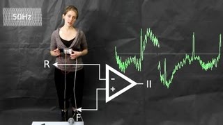 ECG: common artefacts and how to avoid them