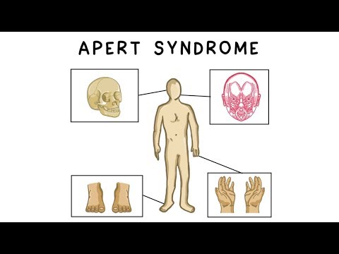 Apert syndrome