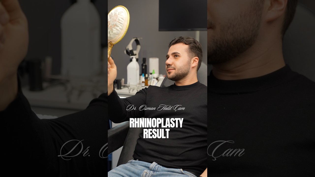 Rhinoplasty Result — Burun Estetiği Sonrası