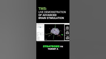 Inside a Real TMS Session: See Brain Stimulation in Action
