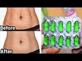 बस 3 मिनट लगा लो पुराने से पुराने स्ट्रेच मार्क्स जड़ से खत्म! Remove Stretch Marks Completely......