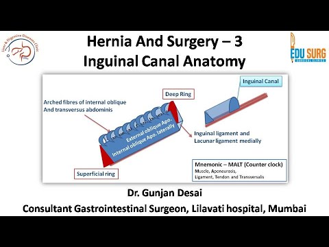 Hesselbach Triangle: What Is It, Location, and More | Osmosis