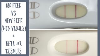 Early 2nd Beta Results + 11DP5DT Tests | Old FRER vs New FRER w/hCG Values | SMBC Journey to Baby #2
