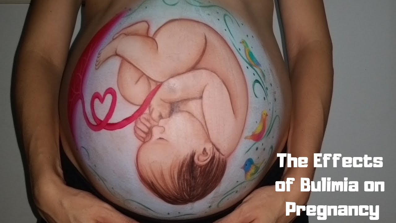 The Effects Of Bulimia On Pregnancy Youtube