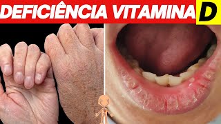 10 SINAIS de que SEU CORPO está IMPLORANDO por VITAMINA D - Deficiência de vitamina D