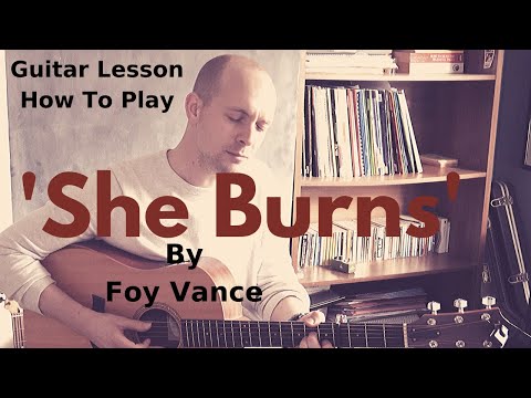 Guitar Lesson - How To Play 'She Burns' by Foy Vance