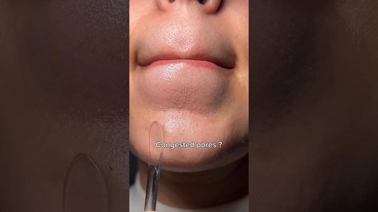 I Cleared My Dark Spots & Acne in 2 Weeks! 🧖‍♀️ My Real Routine for Oily Skin (Affordable K-Beauty)