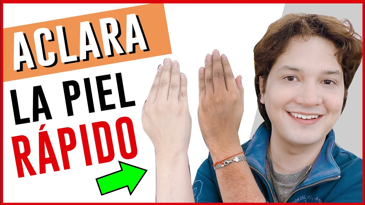 JABON PARA BLANQUEAR LA PIEL QUEMADA POR EL SOL RÁPIDO como aclarar la piel Blanqueamiento JABON PARA BLANQUEAR LA PIEL QUEMADA POR EL SOL RÁPIDO como aclarar la piel Blanqueamiento