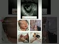 حالات واتس للحوامل